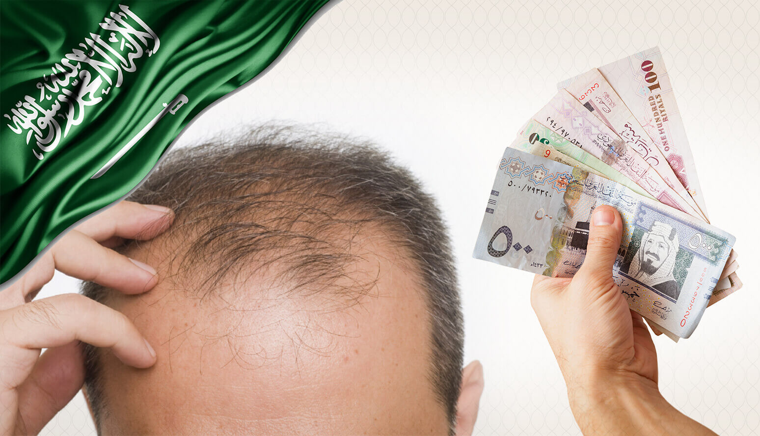 تكلفة زراعة الشعر في تركيا بالريال السعودي